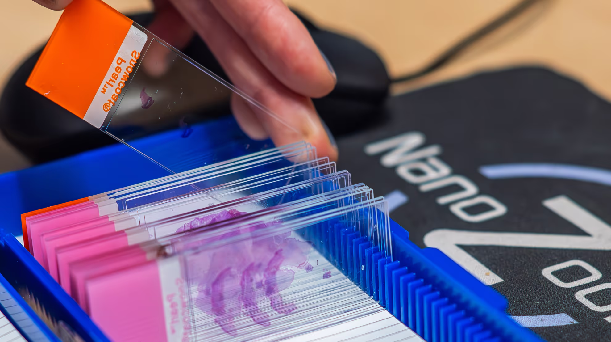 Deciphex raises €15M to scale AI-powered digital pathology and tackle diagnostic delays