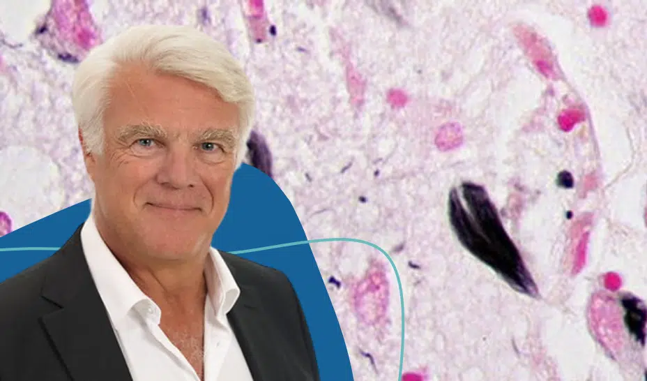 Exciva raises €51M Series B to advance Alzheimer’s neuropsychiatric therapy