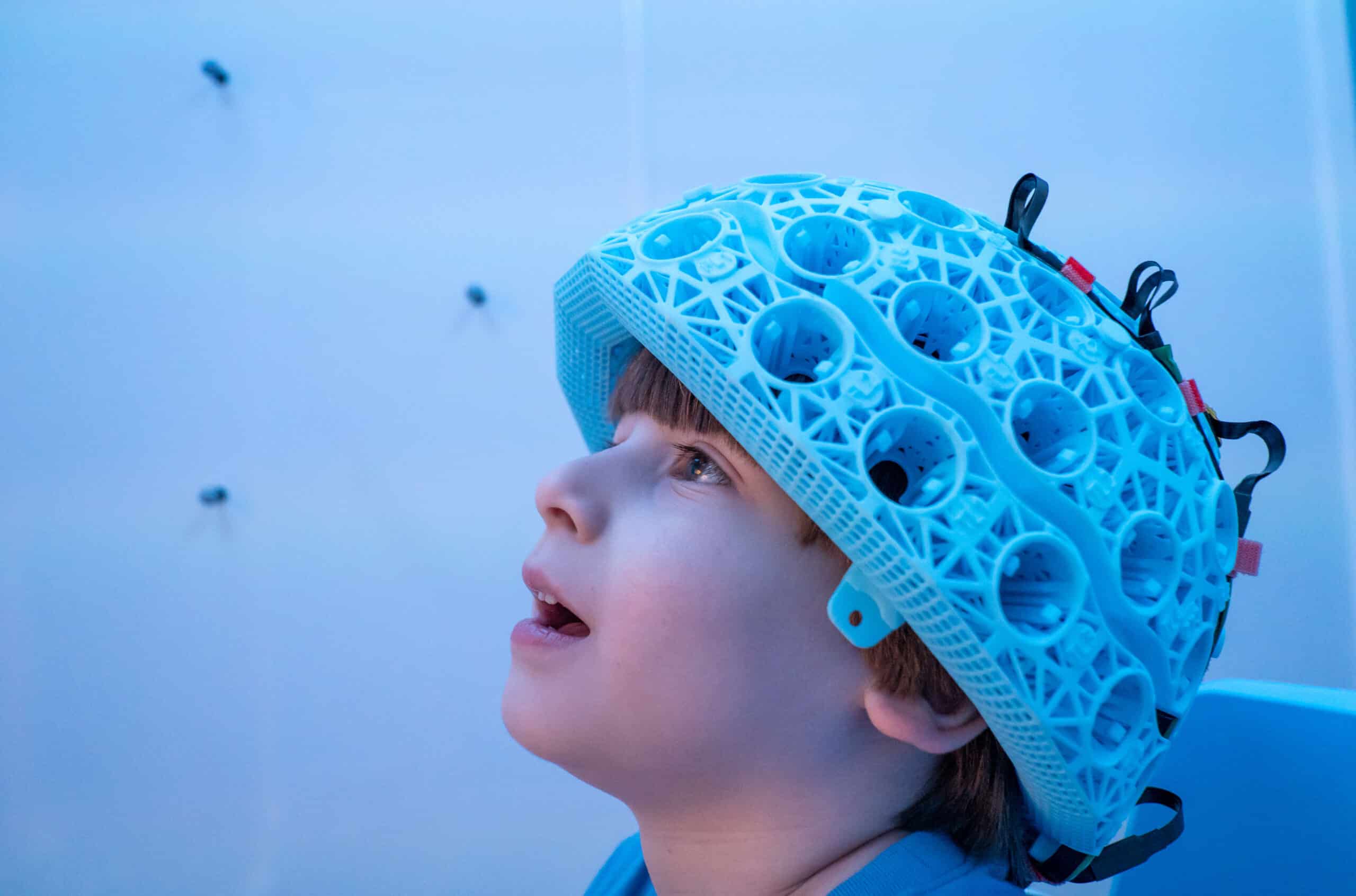 Cerca Magnetics secures €4.3M to expand Wearable Quantum Brain Imaging into Clinical Use