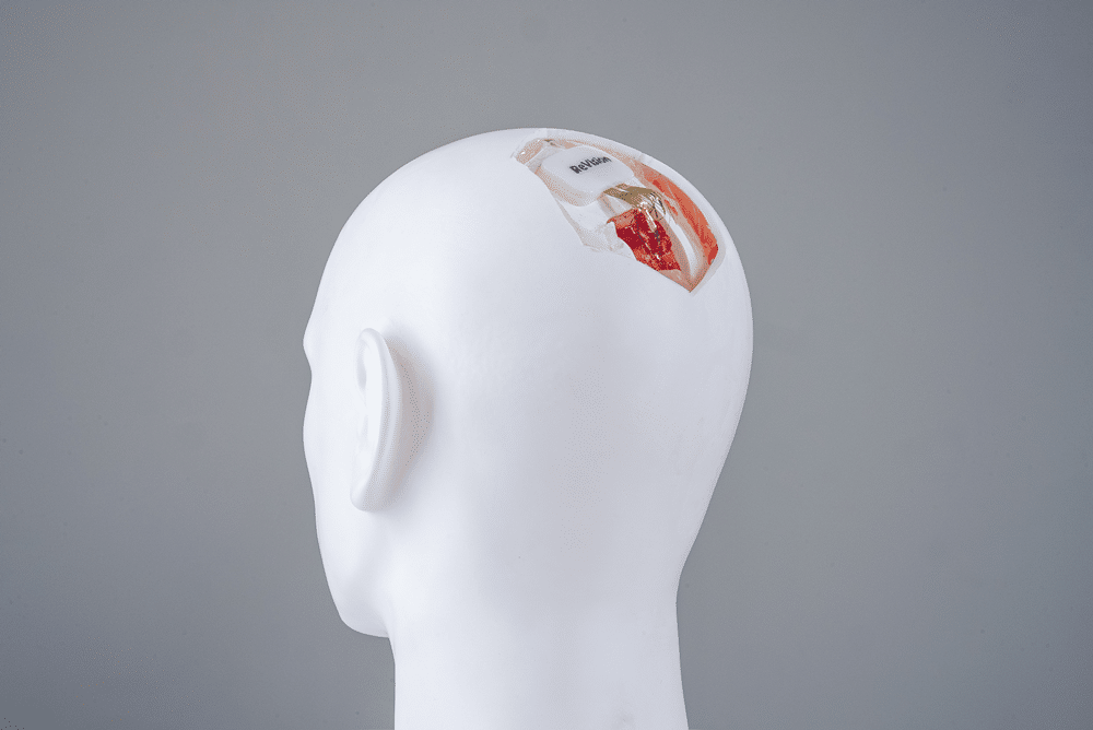 ReVision Implant raises €4M to advance Brain-Based Vision Restoration Technology
